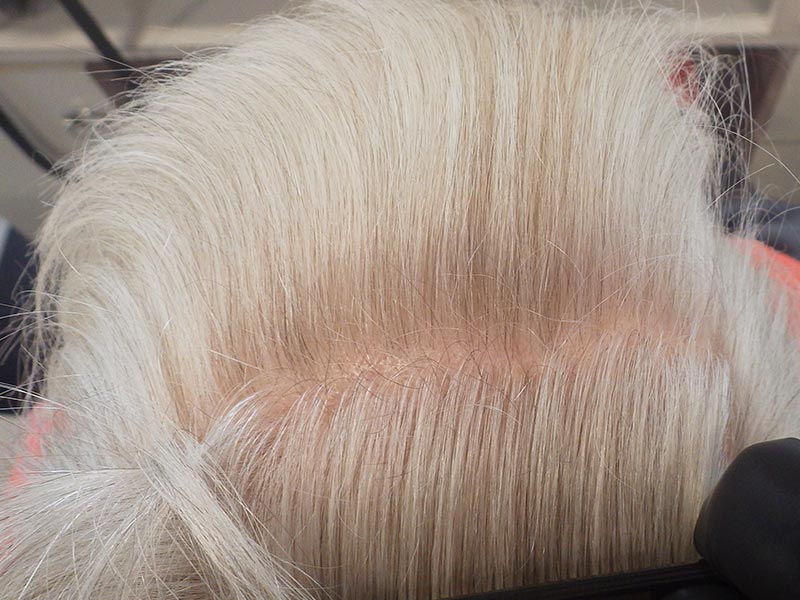 Naissance De Nouveau Cheveux