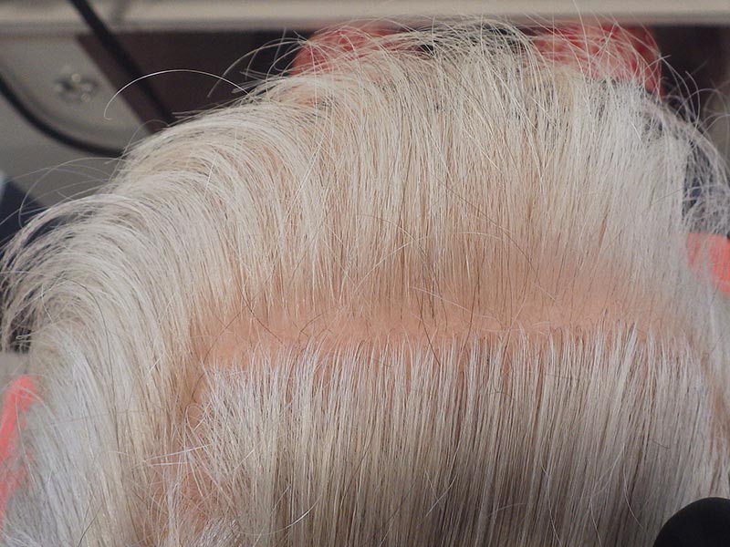 Naissance De Nouveau Cheveux
