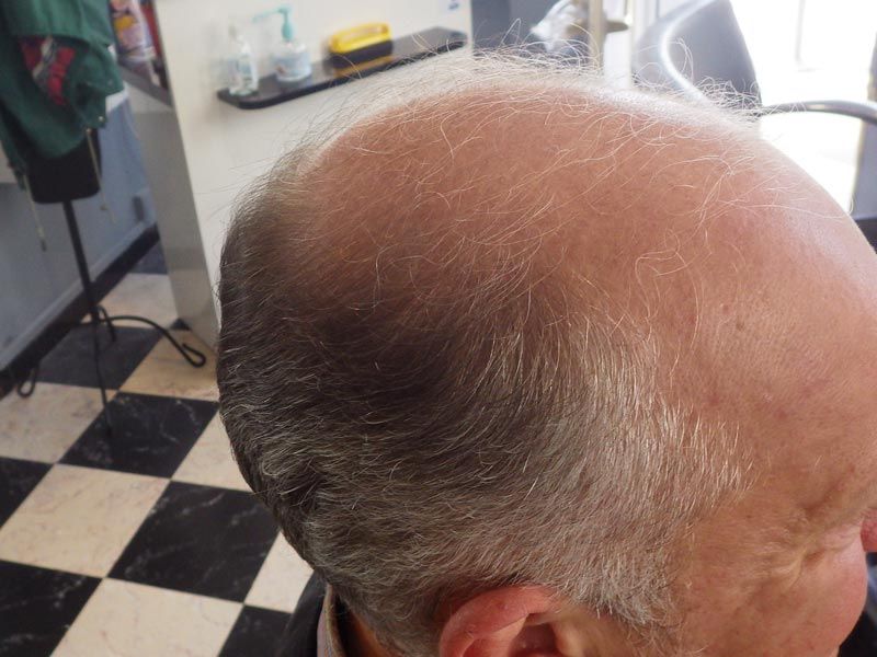 Soins Naturel Repousse Du Cheveux Lille