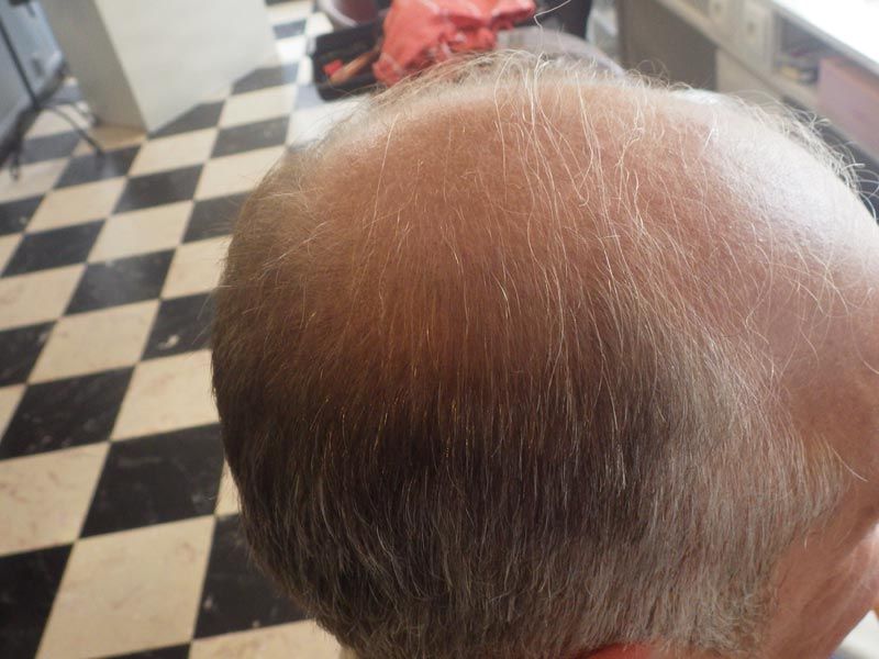 Soins Naturel Repousse Du Cheveux Lille